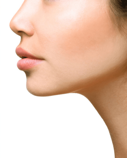 Kybella