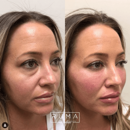 Before and After Images