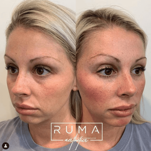 Before and After Images