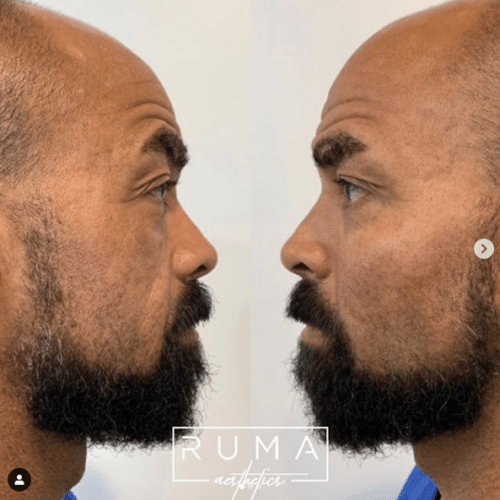 Before and After Images