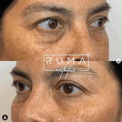 Before and After Images