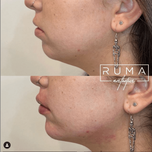 Before and After Images