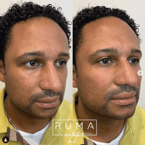 Before and After Images