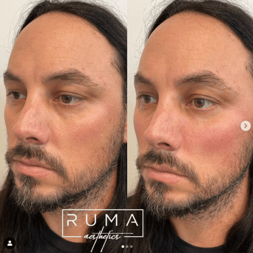 Before and After Images