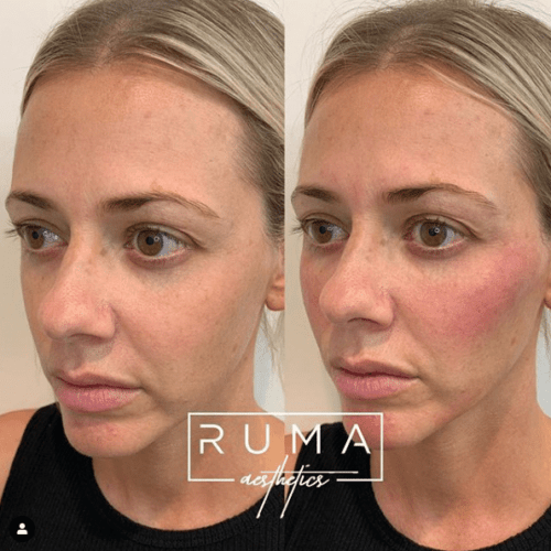 Before and After Images