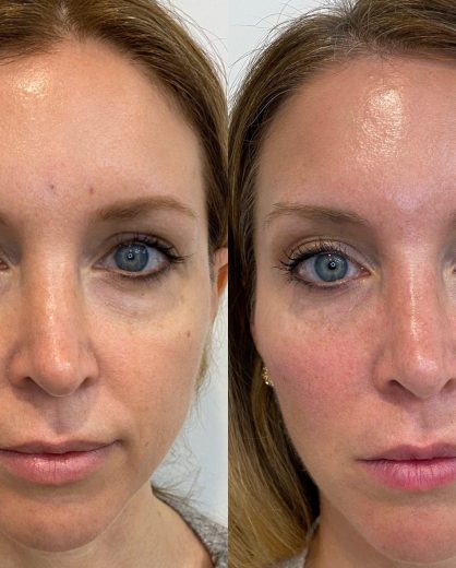 Treatment Before and After