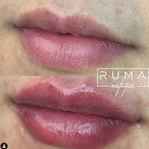 Before and After Images