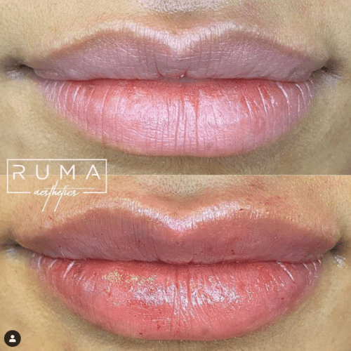 Before and After Images