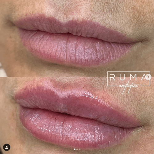 Before and After Images