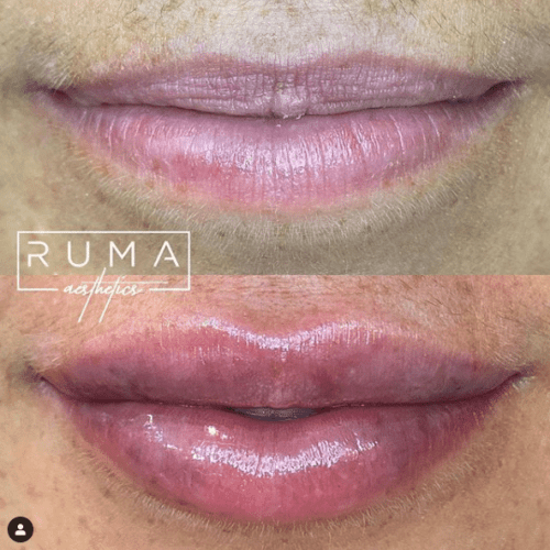 Before and After Images
