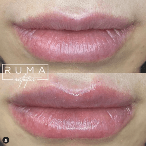 Before and After Images