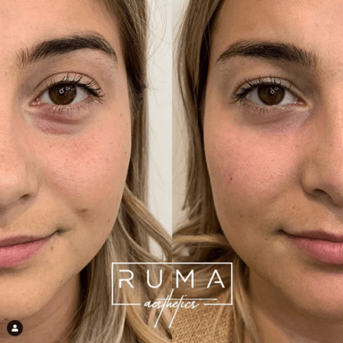 Before and After Images