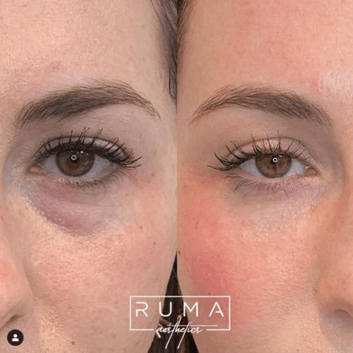 Before and After Images