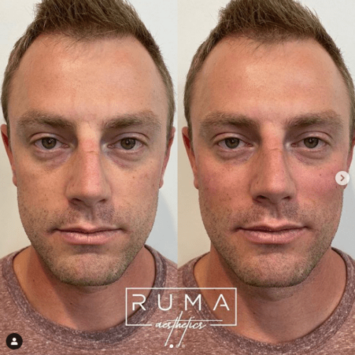 Before and After Images