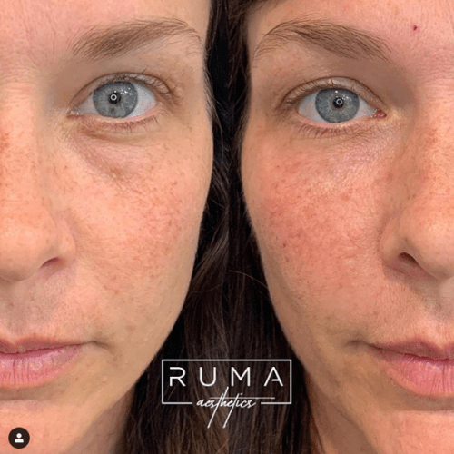 Before and After Images