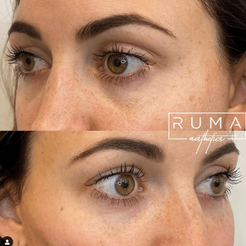 Before and After Images